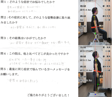 四日市市、女性。変形性膝関節症。