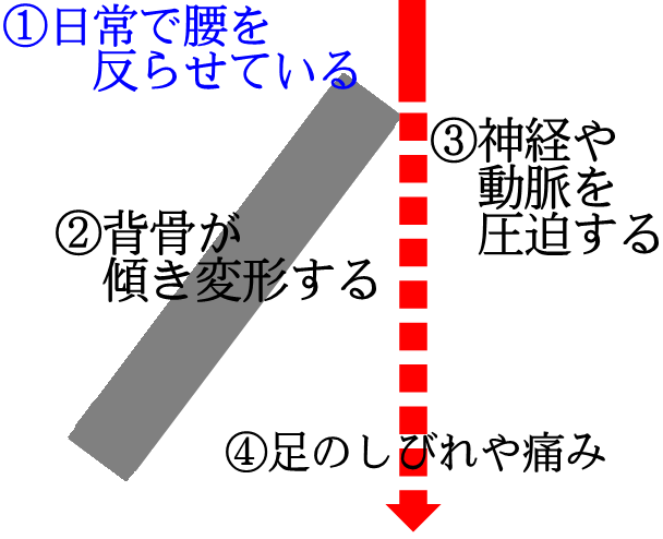 変形性膝関節症を姿勢で変える。姿勢の天才！